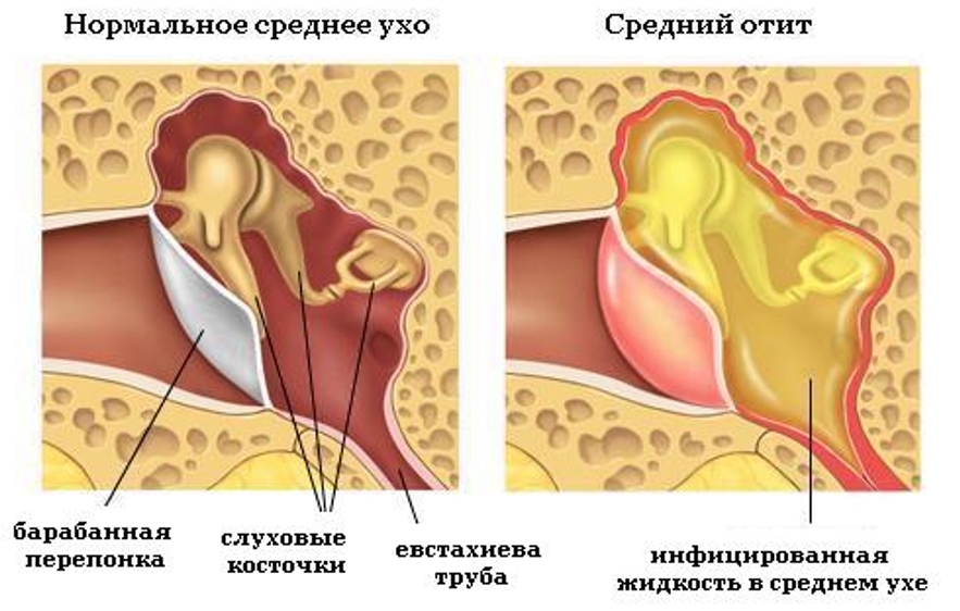 Диагностика причины боли в ушах